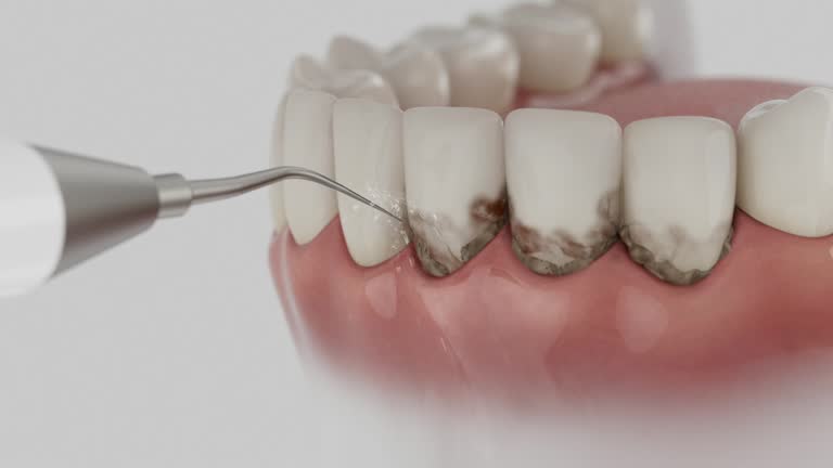 Trusted Teeth Cleaning And Checkup service in Carthage, NY - Dentist Open Now